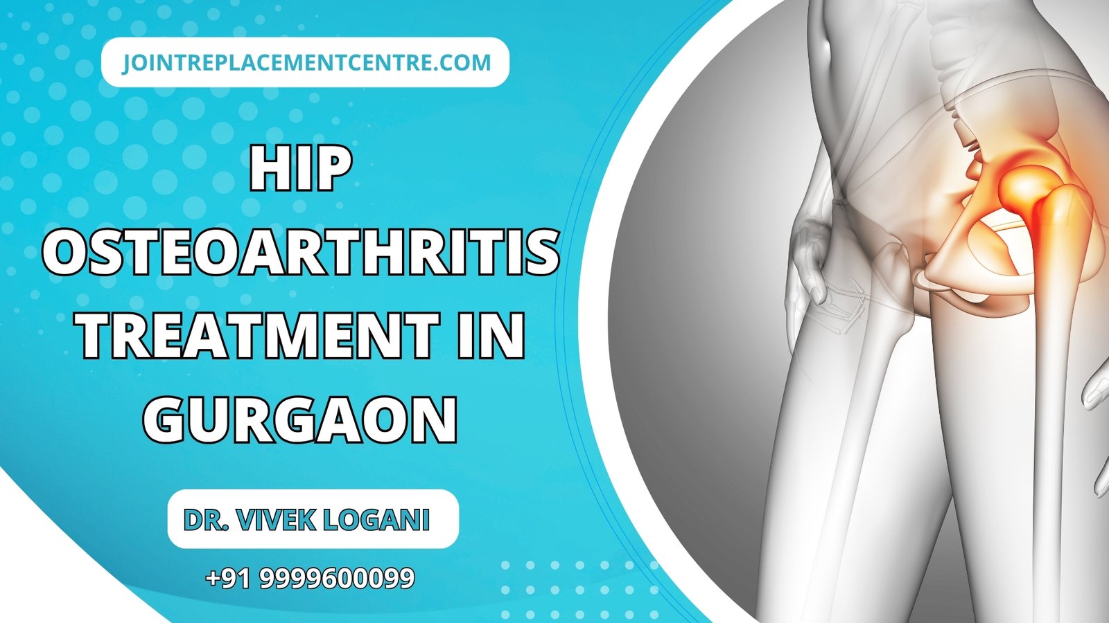 Hip Replacement Surgeon in Gurugram